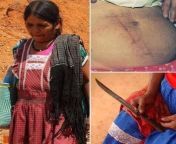 Indigenous resilience!! Ins Ramrez, a zapoteca woman performed to herself a cesarean operation, due to the fact that the nearest docter was kilometers away. After 12 hours of labor, she sat on a bank, drank ethyl alcohol and, with the help of a knife, p from bangla docter porter