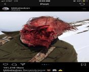 Not me! This man was attacked by a bear while hunting. His Instagram post has since been deleted but one of the slides was a video of him talking with his face looking just like that. from aishhwarya riy a