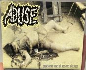 Gruesome Tales of Sex and Sickness cassette j-card front cover that was recently published online. One of the best, if not THE best, quality photos of the front cover currently one. from tales of tied