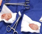 Testicles from testicles castration