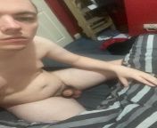 27yo Dirty Exposure Fag. Looking for dirty nasty bi dom lads?. try n shock me ?. Humiliate me. Laugh at me.?. Snap Mikescfc24 from nasty dirty