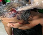 In Kyimyindaing this afternoon, a terrorist group led by Min Aung Hlaing set fire to a public barrier, beat a man to the head and arrested some protesting students. Source :Myanmar Now from lusoegyi myanmar sex comnn