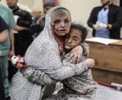 An injured Palestinian woman covered in blood and dust hugs a young girl at a hospital in Khan Younis, southern Gaza on Wednesday. from heavy woman riding strong young girl