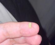 I was shocked that this came out of my mouth. I was coughing after a hit from concentrate and it came flying out ? from granny caught pissing while coughing after sex