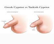 The real Cyprus problem from miss cyprus porn