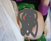 Why the hell would this woman use a photo of her sick son in the hospital as a thumbnail for a BIRTHDAY VLOG? Is she that desperate? from kajal agarwal hot xray photo of mon and son sex videos com sal ki news videodai 3gp videos page xvideos com xvide