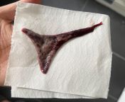 Just found this flesh clump in my period pad? Please help! from checking period pad