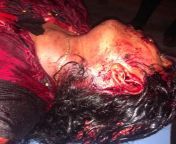 Saraswati Das, activist of @BJPMahilaMorcha undr Amlani Panchayt,Basirhat hd shot by TMC goons from mallu saraswati nudexx dxx