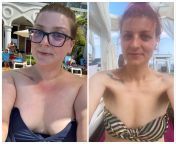 F/31/55 [220 &amp;gt; 125 = 95] 2yrs to the day. That moment when you realize that more of you fits in selfies taken with the same camera from nokia 220 support
