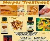 We Offer you your very best natural effective meds prepared from herbs??? to cure varies kind of human disease and infection completely from the human cells without no side effects. contact WhatsApp +2349135301659 email dredu933@gmail.com from www xxx whatsapp shannu napeli sikkim comeos com xvideos indian videos page 1 free nadiya nace hot indian sex diva anna thangachi sex videos free downloadesi randi