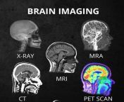 Different types of medical scans from fkk nudism legal scans jpg fkk nudism scan 012 jpg fkk
