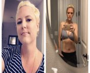 Before and after my 100 lbs weight loss. from naked woman before and after weight loss jpg