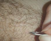 Little ingrown plucked out! (NSFW for pubic area, though nothing is seen) from av4 us little