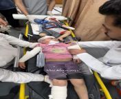 Israeli WAR ON CHILDREN: Israeli occupation strikes on Gaza&#39;s Nusairat refugee camp have mainly injured children, with Israeli forces intentionally targeting residential areas in the Strip since the start of the war. from israeli shoilders
