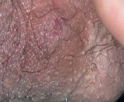 Chemical burn? Used nair hair cause I was last to shave but as soon as I put it on I felt burning on that area so I was thinking it is a chemical or something. If any thoughts Ill greatly appreciate it from sucking on that fat pretty clit then hit it fr0m the back