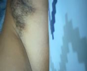 Was diagnosed with HS a year ago. Ive had surgery, taken medication, been to a multitude of doctors and still have painful flare ups. Currently experiencing a huge one (as shown in video). Quite painful and makes everyday life really hard. NSFW from indian vilage youx xxx video downloadi painful fuck 3gp