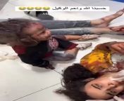 A wounded mother and daughter after a strike on a hospital in Gaza. from german mother and daughter visit a sauna upscaled to 4k