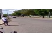 [50/50] A teenager in Brazil rides a 500 foot long wheelie (SFW) &#124; A mans face peels off after a horrific motorcycle accident. (NSFL?) from teenager in love