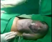 Unassisted C-section delivery en caul from unassisted labor